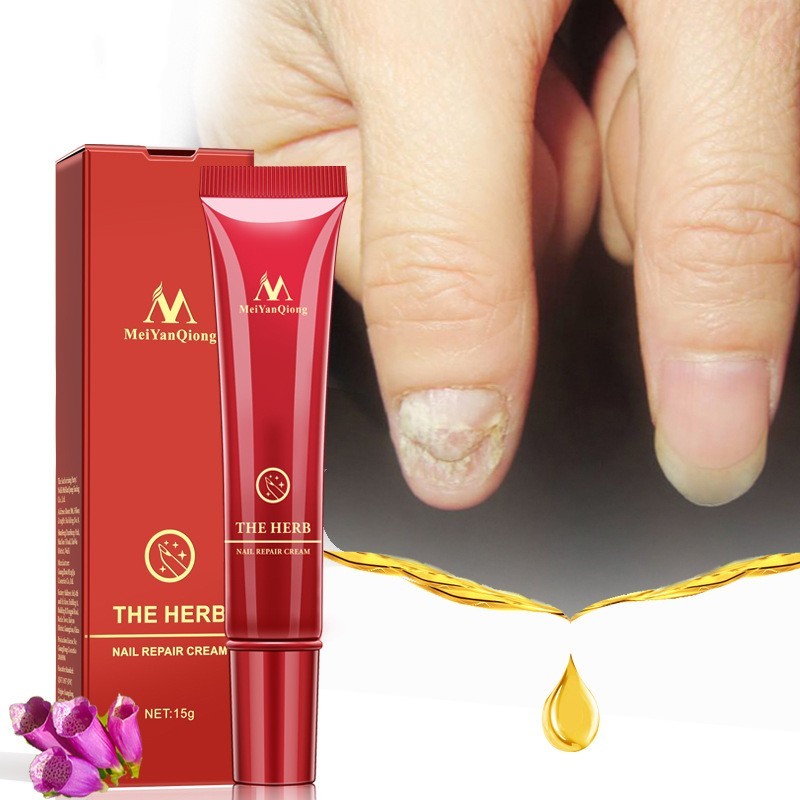 Beauty Hand And Foot Nail Repair Cream