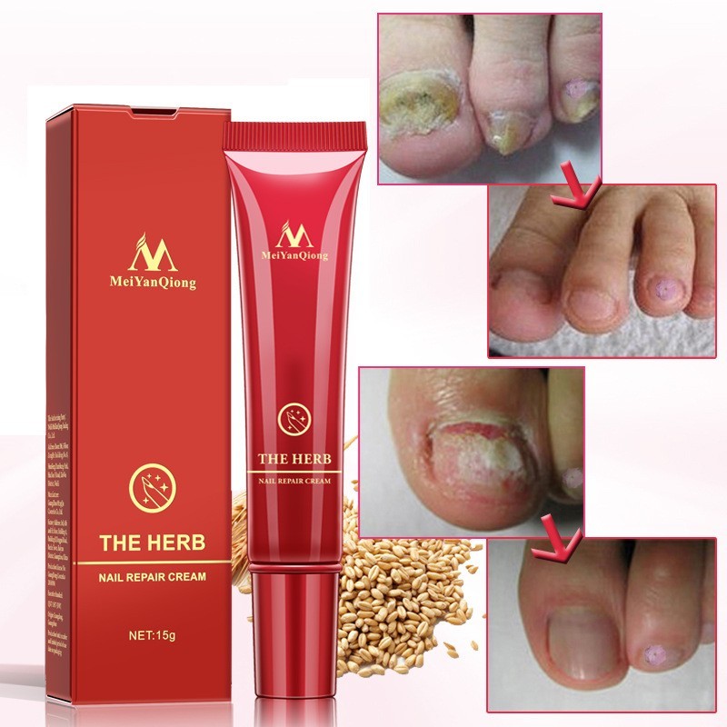 Beauty Hand And Foot Nail Repair Cream